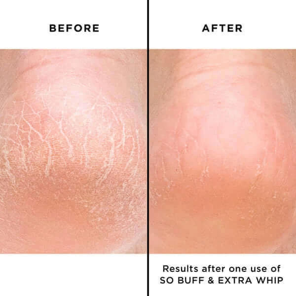 Extra Whip - Image 5