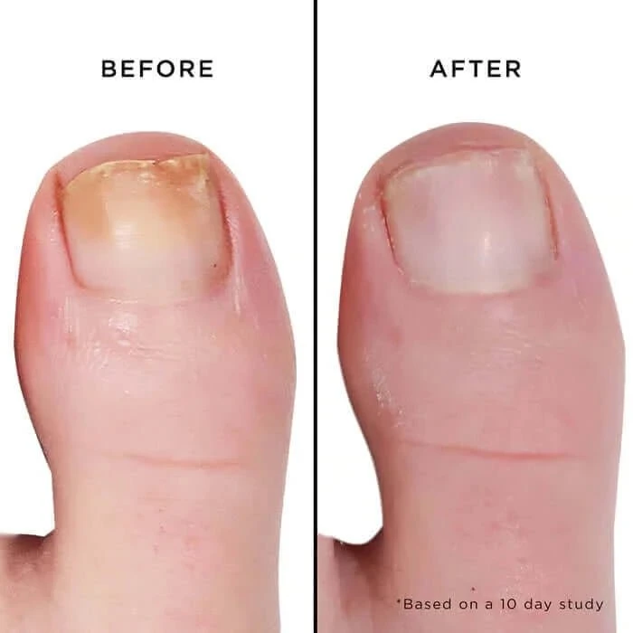 Fashion Size Mellow The Yellow Nail Brightening Treatment - Image 3