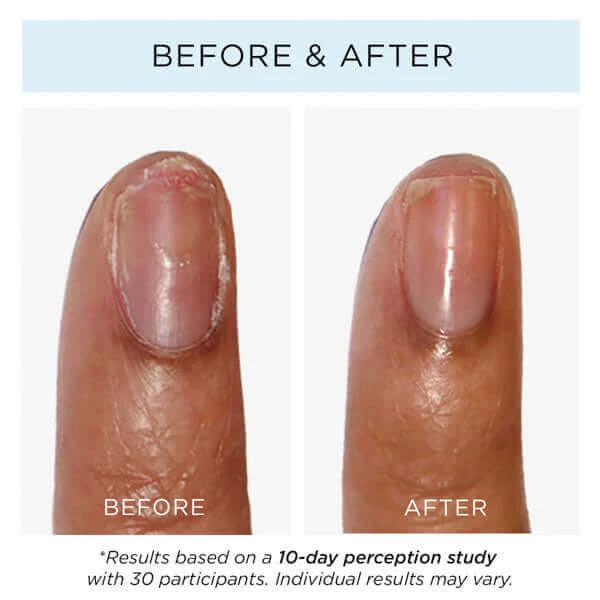 Strawberry Rhubarb Jelly Preserve Strengthening Treatment - Image 4